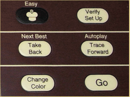 Excalibur Model 310E Karpov 2294 (1997) Push Button Game Controls